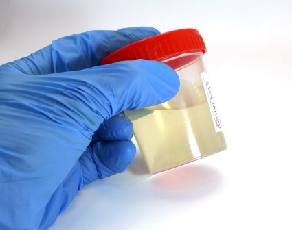 Synthetic 
      Urine With Urea Palisade Gardens San Diego CA